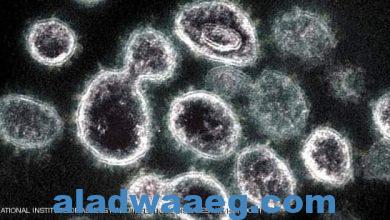 صورة صورة مجهرية لفيروس كورونا المسبب لمرض كوفيد-19. 3.2مليار دولار لتطوير دواء كورونا