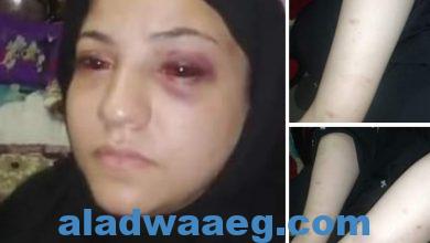 صورة زوج يعتدي على زوجته بالضرب المبرح ويجبرها التنازل عن حقوقها في الزقازيق