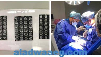 صورة إجراء أول التداخلات الجراحية الميكروسكوبية للمخ والأعصاب بمستشفى سوهاج الجامعي الجديد