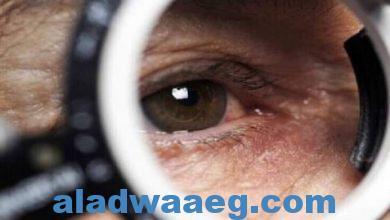 صورة طبيبة روسية توضّح لماذا تتفاعل العيون مع أمراض البرد…