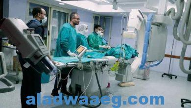 صورة مستشفى قنا العام تنجح في إجراء أول عملية قسطرة مخية على مستوى الصعيد.