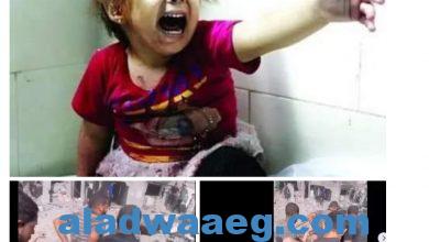 صورة «أنا عايشة ياعمو» صدمة طفلة فلسطينية بعد انتشالها من تحت الأنقاض